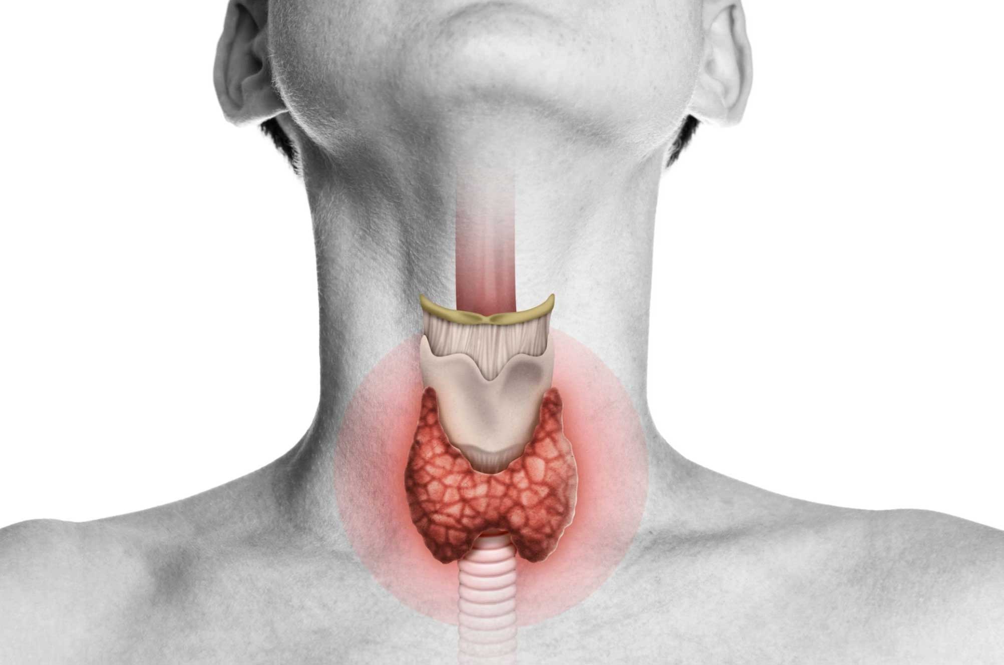 Thyroid – Endocrine Surgery – Fernando Monraz